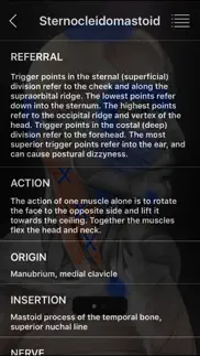 muscle trigger points alternatives 3