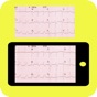 Similar ECG Reader Apps