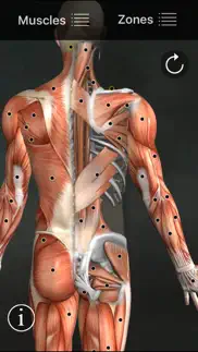 muscle trigger points alternatives 1