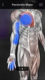 muscle trigger points alternativer 4