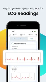 blood pressure app smartbp alternatives 7