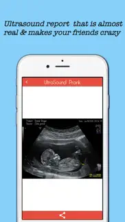 baby ultrasound spoof alternatives 2