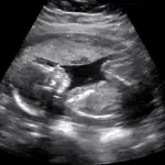 Baby Ultrasound 2015 alternatives