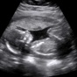 Similar Baby Ultrasound 2015 Apps
