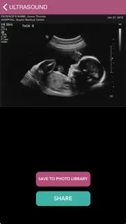 baby ultrasound 2015 alternatives 1
